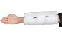 AliMed® Elbow Immobilizer, Adult